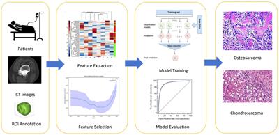 Development of the interpretable typing prediction model for osteosarcoma and chondrosarcoma based on machine learning and radiomics: a multicenter retrospective study